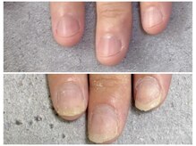 グレースレディ/新しい爪を綺麗に伸ばす