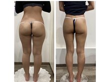 ココ平塚店(COCO)/coco自慢の痩身5種類のマシン