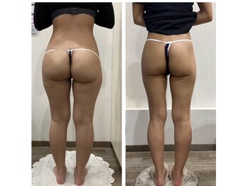 ココ平塚店(COCO)/coco自慢の痩身5種類のマシン