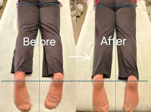 スノー シャイン(SNOW SHINE)