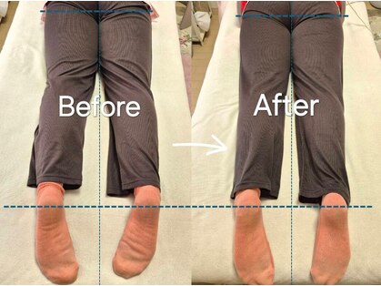 スノー シャイン(SNOW SHINE)の写真