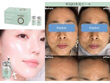 リスキン(Reskin)の雰囲気（【WIQO水光ピール】即効性、確実な効果をお求めの方におすすめ!!）