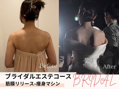 痩身&ブライダルエステサロン MillS 小倉店【3/2 NEW OPEN（予定）】の写真