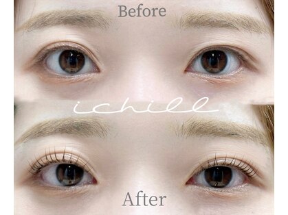 イチル(ichill)の写真