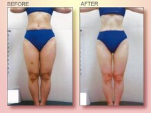 ジュリア オージェ 四条河原町店/ビフォーアフター（ターゲット)