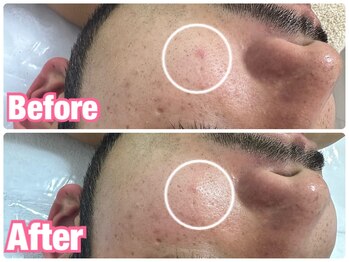 ビューティービューティー(BEAUTY BEAUTY)/陶肌トリートメント