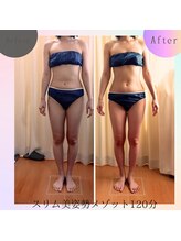 クリオネ(Clione)/まずは姿勢から！！究極の痩身！