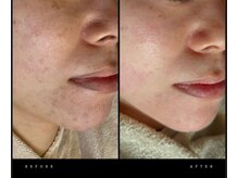 ワイケー(yk)/プラズマ！