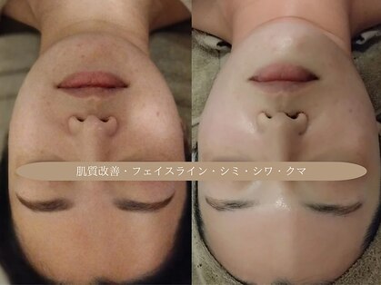 ディアナ 代々木上原(_Diana)の写真