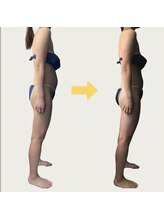 ネオボディ(Neo Body)/施術期間1ヶ月