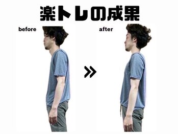 すぎの森鍼灸整骨院/楽トレ上記のパッドで施術1回目