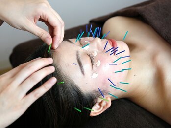 サプル(supple)/【美容鍼灸】ぜひお試しください