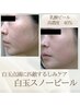 しみ、くすみにお悩みの方◎高濃度乳酸ピールで美白ケア♪もっちり白玉肌へ