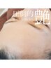 うる艶リフトアップ♪筋膜リリース&高濃度美容液ポレーションお試し9000円　