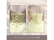 レゾン 京橋店の雰囲気（《ビフォーアフター》二の腕や背中ケアなどのブライダルエステ◎）