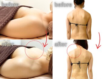 キャニー(cany)/施術5回&施術3回