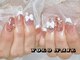 ヨロネイル(YOLO NAIL)の写真/豊富な種類のカラー&最新パーツの中から自分だけのオリジナルデザインが叶う♪持ち込みデザイン対応可★
