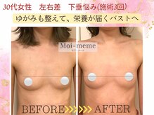 モワメーム(Moi-meme)/