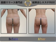 プレリー 自由が丘店/筋膜リリース＆セルゼロ