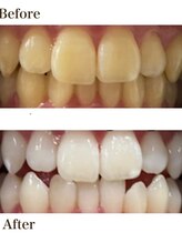 カノン 南熊本店(Kanon)/