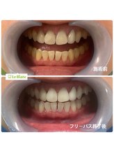 ルブラン 奈良店(Le Blanc)/これからの季節に！