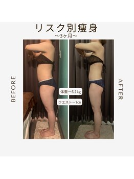 ビーシェイプ 君津(B-Shape)/【痩身】ビフォーアフター