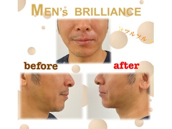 メンズブリリアンス(MEN’s BRILLIANCE)/★ヒゲWAXでマイナス○○歳！★