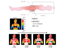 インディバだから出来る細胞レベルのケアで全身整えます