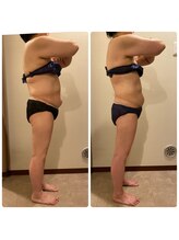 エステティック レイビス 青森店(RAYVIS)/着たい服を着れる体に☆