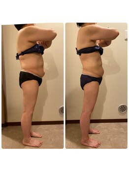 エステティック レイビス 青森店(RAYVIS)/着たい服を着れる体に☆