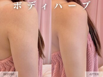 レヴェリー 心斎橋店(REVERIE)/ボディハーブ（背中＋二の腕）