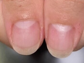 アリスビューティーサロン(ALICE BEAUTY SALON)の写真/フォルムにこだわり丁寧にお仕上げ♪深爪のお客様も美爪間違いなし！突発的な爪のトラブルにも対応◎