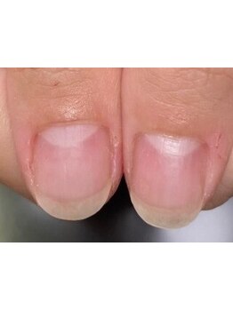 爪の悩みを解消できる（ケア含む）