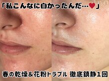 スキンラボアメリ(skin lab. ameri)