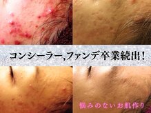 ベリス(BELLIS)の雰囲気（【お肌に悩みがある方＆綺麗になりたい方】）