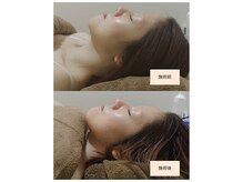 吉川美南ライフ整骨院/30代女性