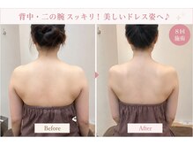 ベルビー エルエル岡崎店/背中ライン改善