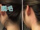 美宝 元町の写真/３２年愛され続ける実力派の０美肌脱毛◎脱毛しながらうるツヤ美肌へ★最短４カ月で卒業です♪８歳からOK◎