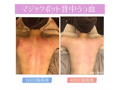 エービューティー(A beauty)の写真
