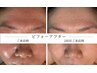 【赤み・揺らぎ・ゴワつきに】敏感肌の為のトラブル集中ケア　