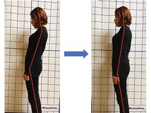 てぃ～だ/猫背を解消☆【王子駅/整体】