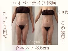 フォーユー マシバメディカル(For You Mashiba Medical)/ハイパーナイフ１回