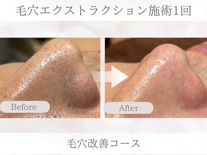 ビスイ 恵比寿(Bisui)の写真