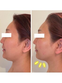 サロンニコ(salon Nico)/顔筋コルギ90分フェイシャル