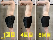 ペリー(PELLY)/男性20代　before after