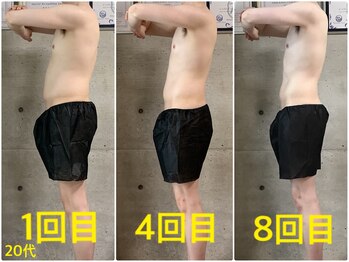 ペリー(PELLY)/男性20代 before after