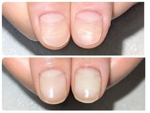 凹凸のある爪も肌からキレイに♪