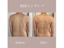 カノン(Kanon.)/ボディ インディバ