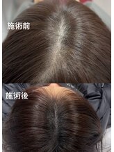 ワンダー(WONDER)/お問い合わせもできます。