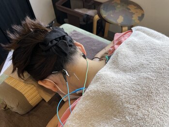 はりきゅう院 さくら/頭痛・肩こり・首こり